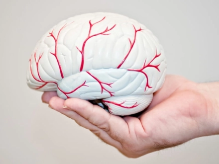 La efectividad del Tuina para mejorar las secuelas de un accidente cerebrovascular