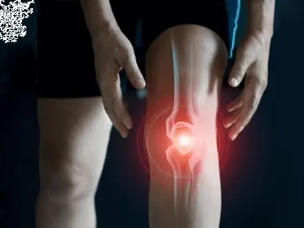 Tratamiento osteopático versus programa de ejercicio en corredores con síndrome de dolor femororotuliano